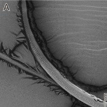 Image of the Day: Beetle Penis Image of the Day: Beetle Penis
