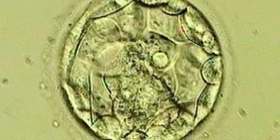 CRISPR Used in Human Embryos to Probe Gene Function | The Scientist
