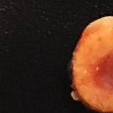 Synthetic Bones: A Better Bone-Marrow Transplant?