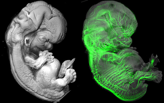 human embryo development day by day