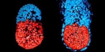 Embryo エンブリオ Meet the First Artificial Embryo Made From Stem Cells | The Scientist