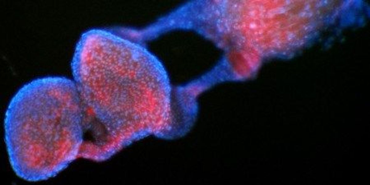 How Bacteria Interfere with Insect Reproduction | The Scientist
