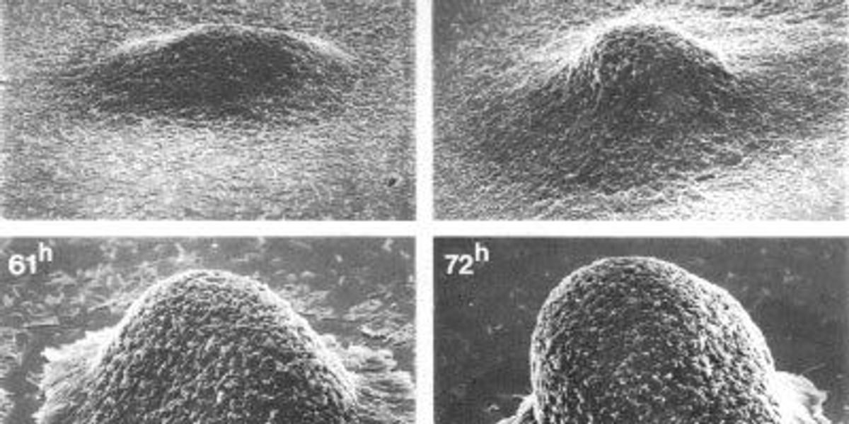First Micrographs of Myxobacteria Forming Fruiting Bodies | The