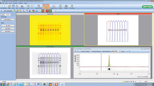 Software For Image Analysis The Scientist Magazine