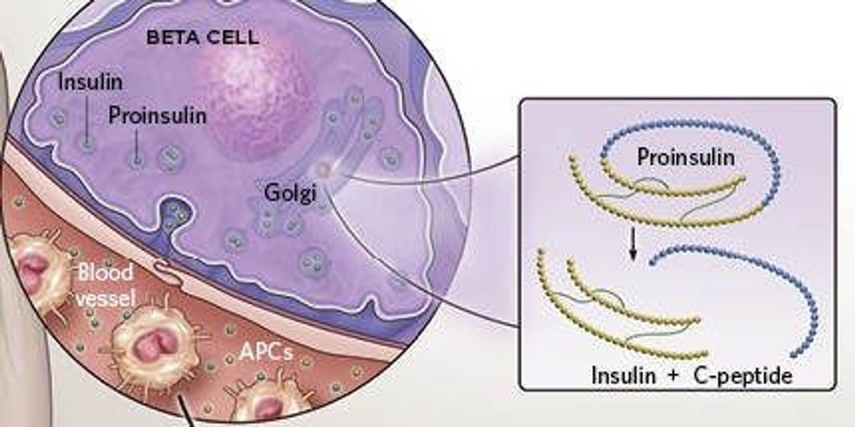 glutathione and iron Type 1 diabetes: MedlinePlus Genetics
