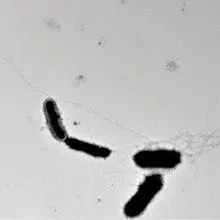 Amyloid Thwarts Microbial Invaders | The Scientist