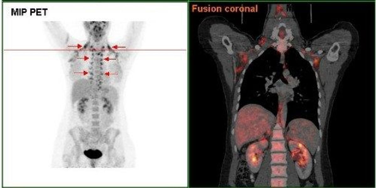 dnp fat burner wiki