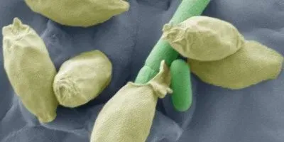 image-of-the-day-seeing-spores