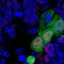 New Stem Cell Identified | The Scientist