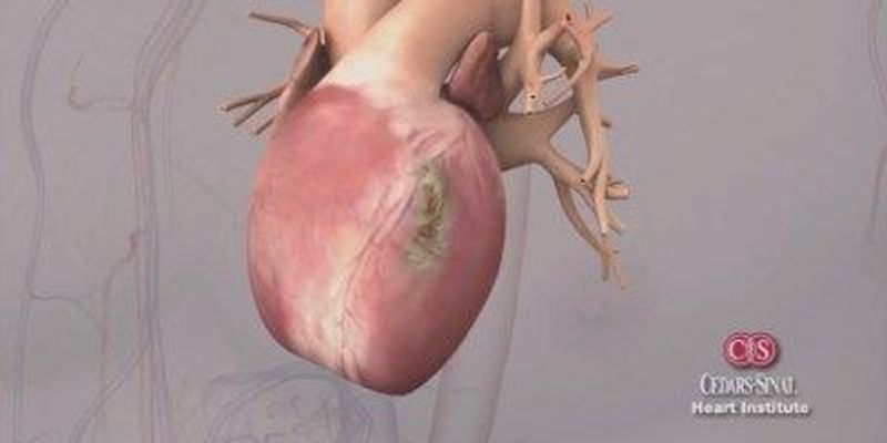 Heart Strings | The Scientist
