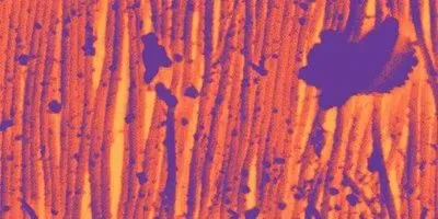 Image of the Day: Strong Skin | The Scientist