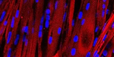 Photogenic Muscle Image of the Day: Lab-Grown Muscle | The Scientist