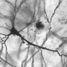 Neurons Regenerate in Rat Spinal Cord | The Scientist