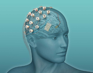 Experiment: Build and Control your own DIY Neuroprosthetic: a