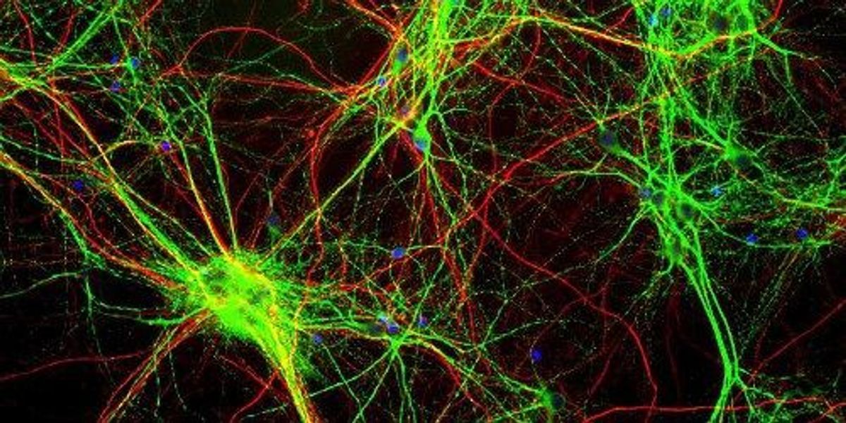 lab-grown-3-d-brain-tissue-