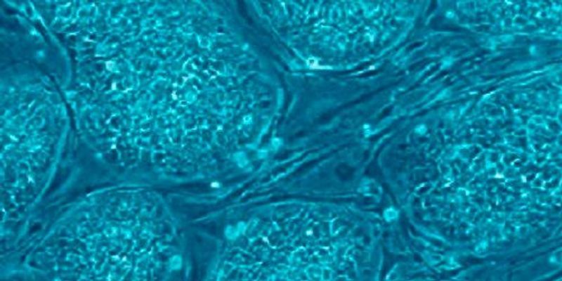 Neural Stem Cells Sprout Long Axons | The Scientist