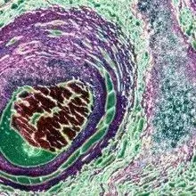 Stem Cells for Autism? | The Scientist
