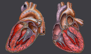 diseased human heart