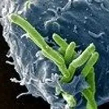 Image of the Day: Bacterial Infection | The Scientist