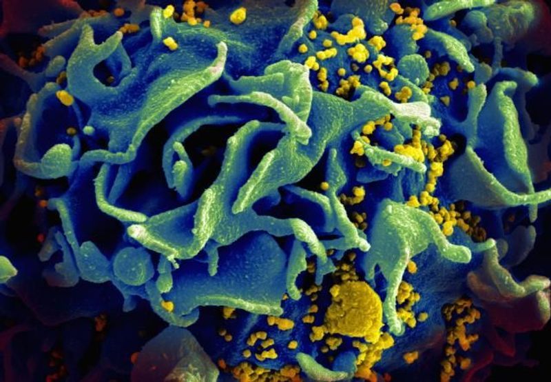 How HIV Destroys Immune Cells | The Scientist MagazineÂ®