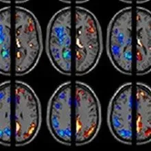 Brain-Based Labels Bunk? | The Scientist