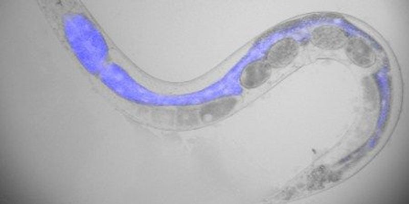 Image of the Day: Visualizing Death | The Scientist
