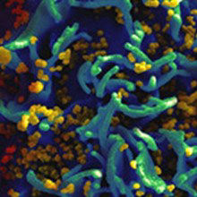 Cure for HIV-Infected Newborns? Cure for HIV-Infected Newborns?