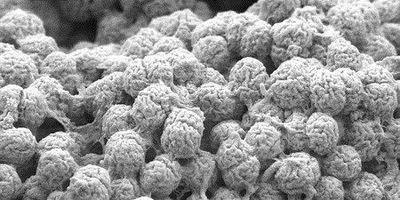 Image of the Day: Algae Clumps | The Scientist