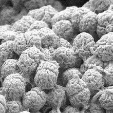 Image of the Day: Algae Clumps | The Scientist