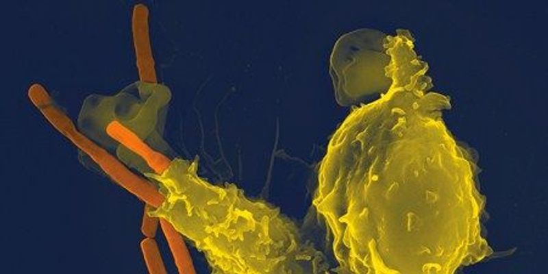 Image Of The Day Anthrax Killer The Scientist