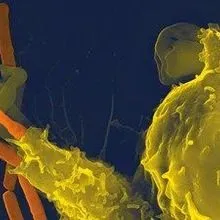 Image Of The Day Anthrax Killer The Scientist