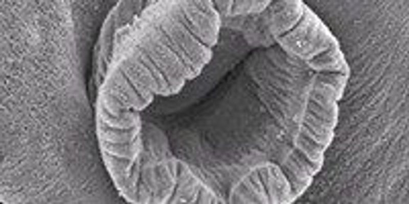 Image of the Day: Clingy Worms | The Scientist