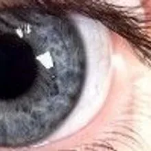 The Meaning of Pupil Dilation | The Scientist