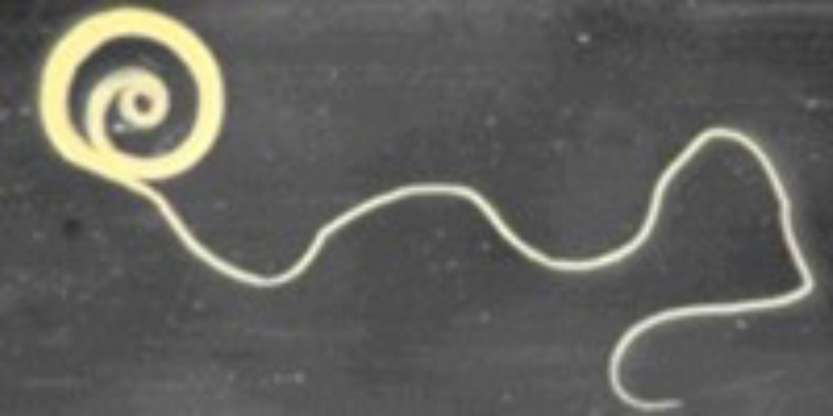 Probiotic Therapy Alleviates Autism >> Can Worms Alleviate Autism The Scientist Magazine Probiotic Therapy Alleviates Autism >> Can Worms Alleviate Autism The Scientist Magazine
