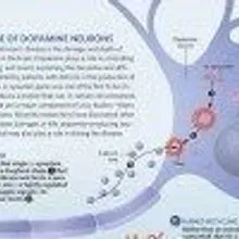Image showcasing Death or Damage of Dopamine Neurons | The Scientist