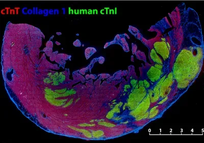 Cardiac Cell Transplants Help Monkeys’ Hearts | The Scientist