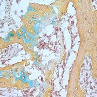 Human Skeletal Stem Cell Found Human Skeletal Stem Cell Found