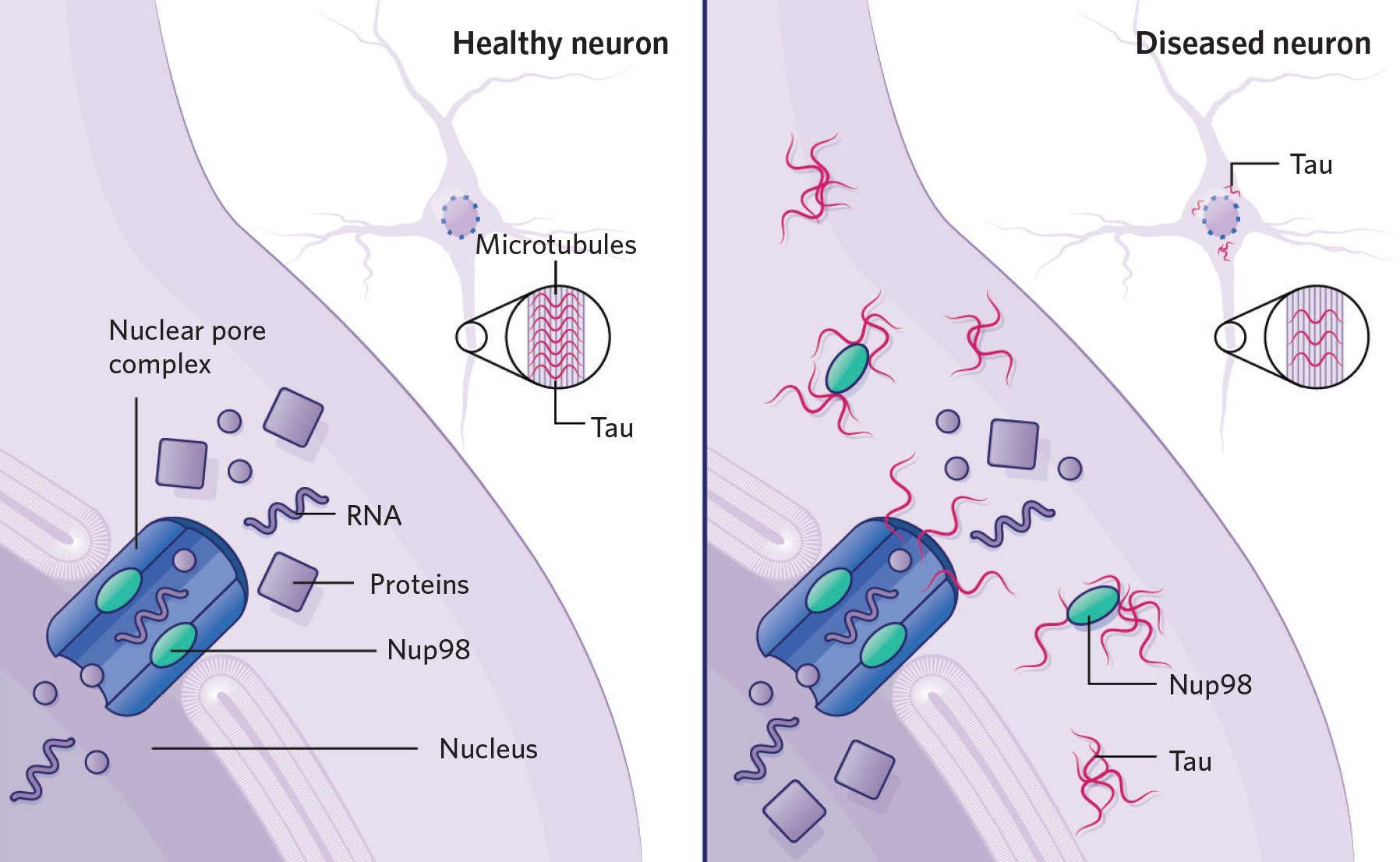 Faulty Cell Transport System Implicated In Alzheimers - 