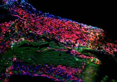 Connective Tissue | The Scientist
