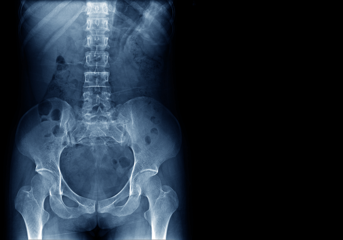Japan Approves iPS Cell Therapy Trial for Spinal Cord Injury | The