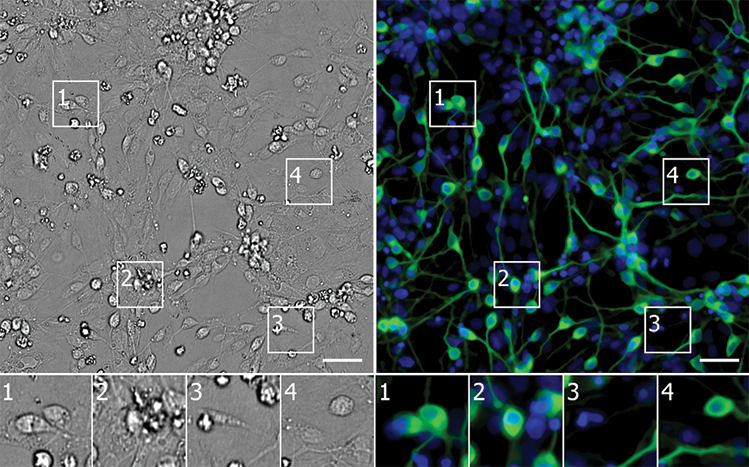 PAINT BY NUMBERS: Using unlabeled images, a neural network identifies neurons derived from induced pluripotent stem cells (green) in a culture containing diverse cell types (nuclei in blue).