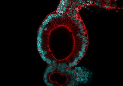 Image of the Day: Colorful Colonoids | The Scientist