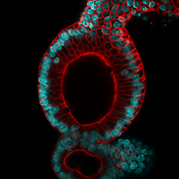 Mouse organoid Actin phalloidin tumor suppressors colorectal cancer