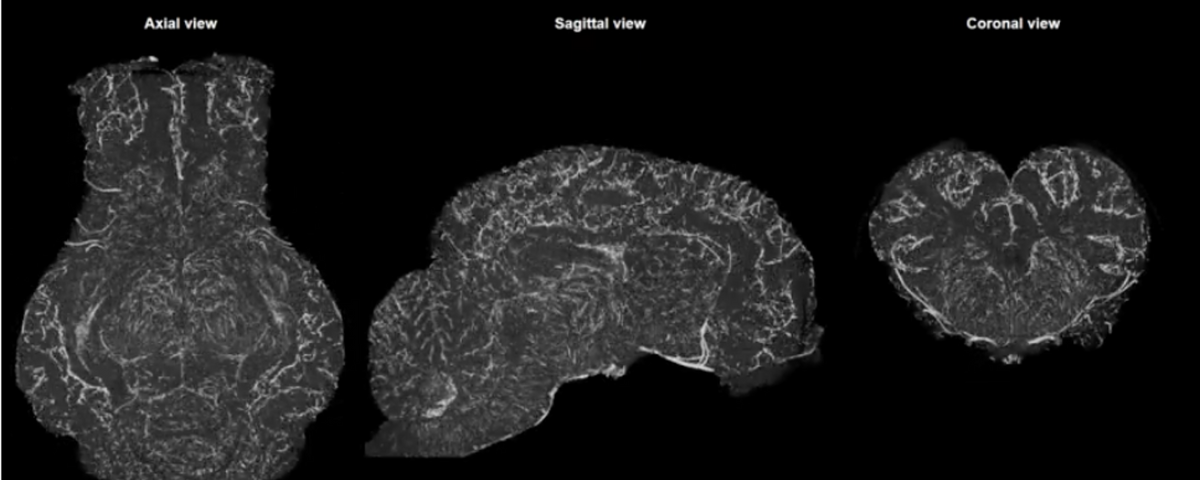 Circulation And Cell Function Revived In Dead Pigs Brains The