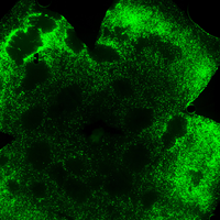 gene therapy mouse mice model retinal disease retinitis pigmentosa