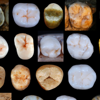 hominin teeth evolution neanderthal modern human divergence fossil record