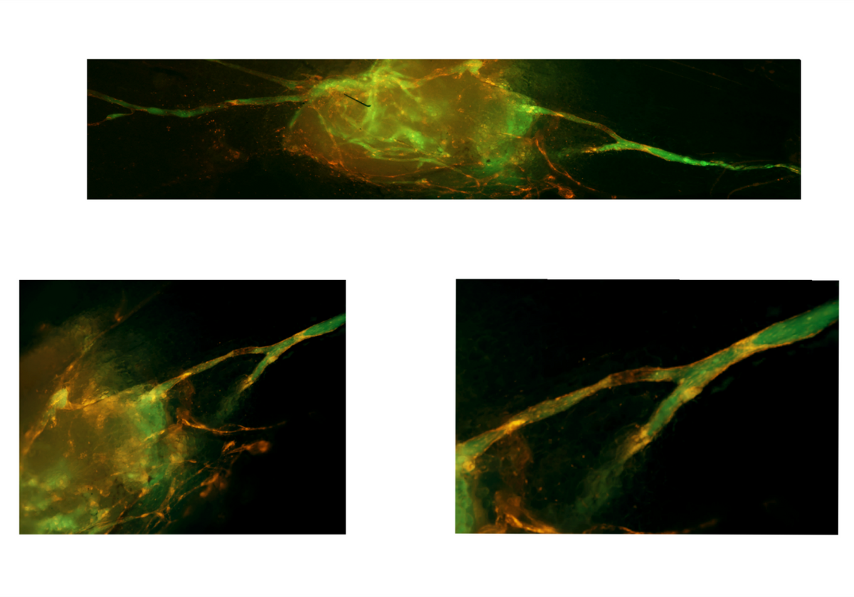 Lab Generated Lymph Nodes Connect To Lymphatic System In Mice