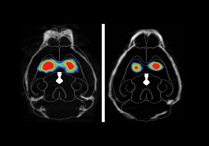 Mouse Model Shows How Parkinson's Disease Begins in the Gut The