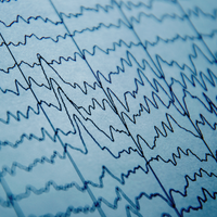 brain activity brainex perfusion