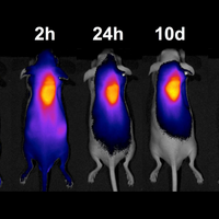 Hydrogel injected near tumors help recruit cancer drugs to the site